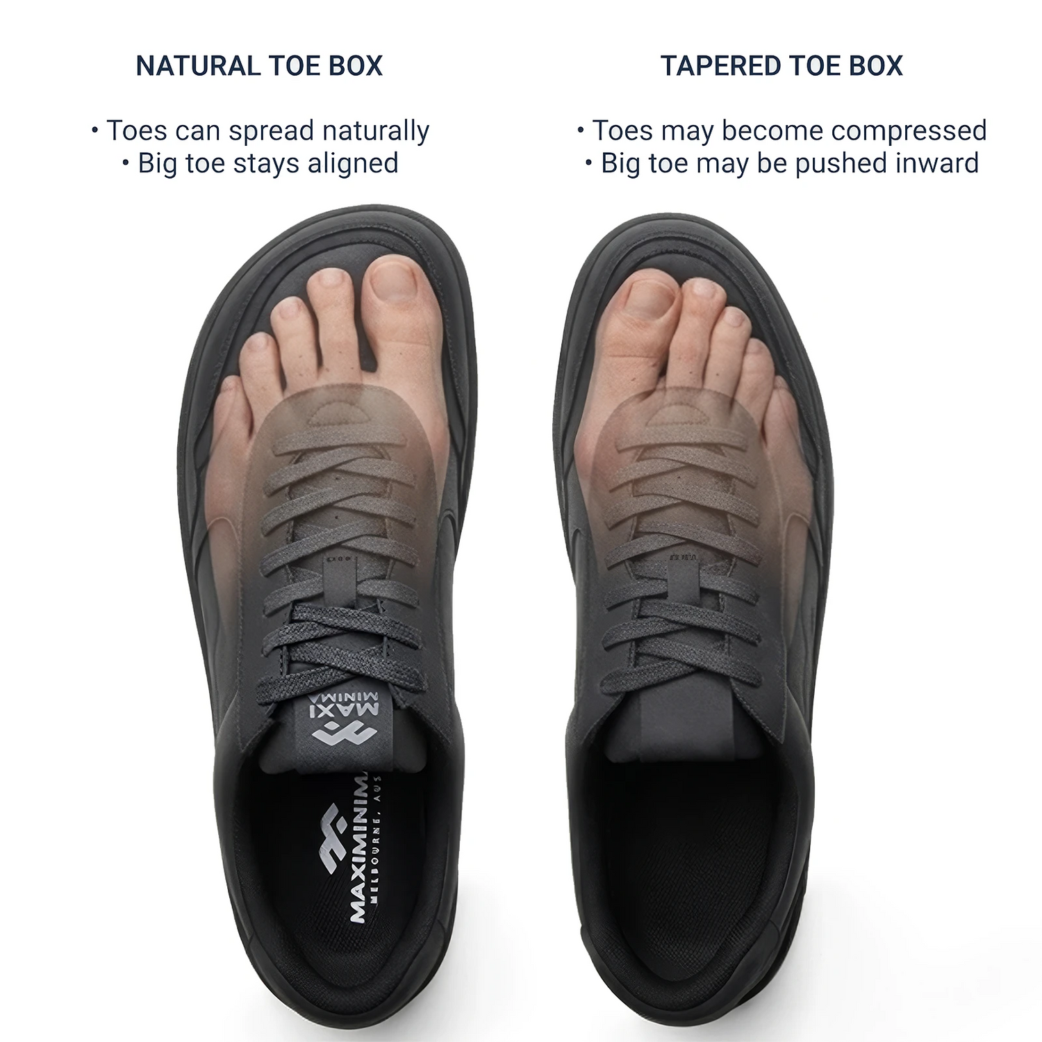 Comparison showing natural toe box barefoot shoe versus narrow tapered shoe and big toe alignment